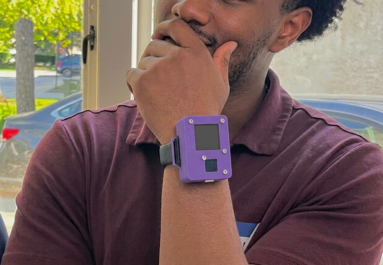 SeniorSafe prototype worn on the wrist, showing the assembled sensor and display stack